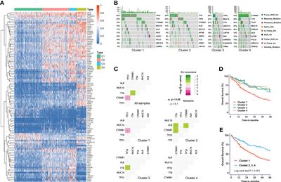Characterization of heterogeneous metabolism in hepatocellular carcinoma identifies new therapeutic target and treatment strategy